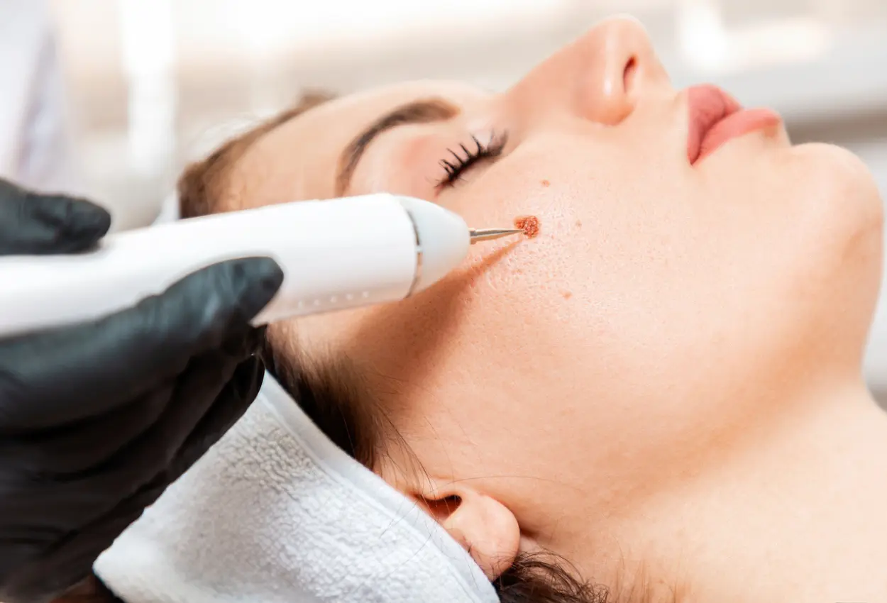 Frequently Asked Questions About Multiple Cryotherapy Treatments Southend-on-Sea