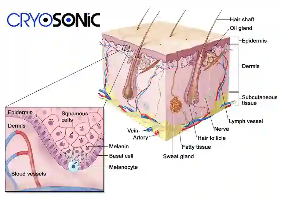 How Cryotherapy Stimulates Melanocyte Activity Southend-on-Sea